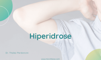 Você sofre de Hiperidrose ? Veja como a Microfisioterapia pode ajudar!