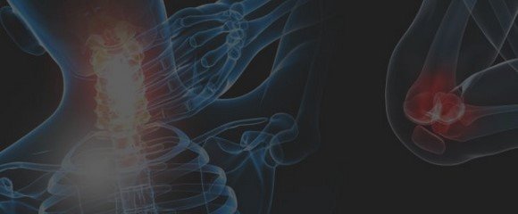 fibromialgia