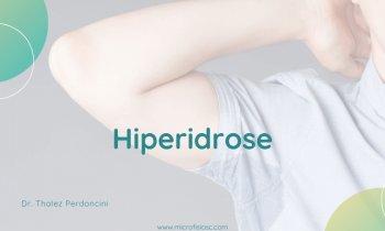 Você sofre de Hiperidrose ? Veja como a Microfisioterapia pode ajudar!